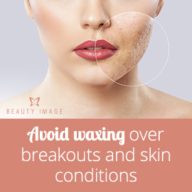 The Benefits of Facial Waxing